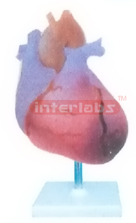 MYOCARDIAL INFARCTION MODEL